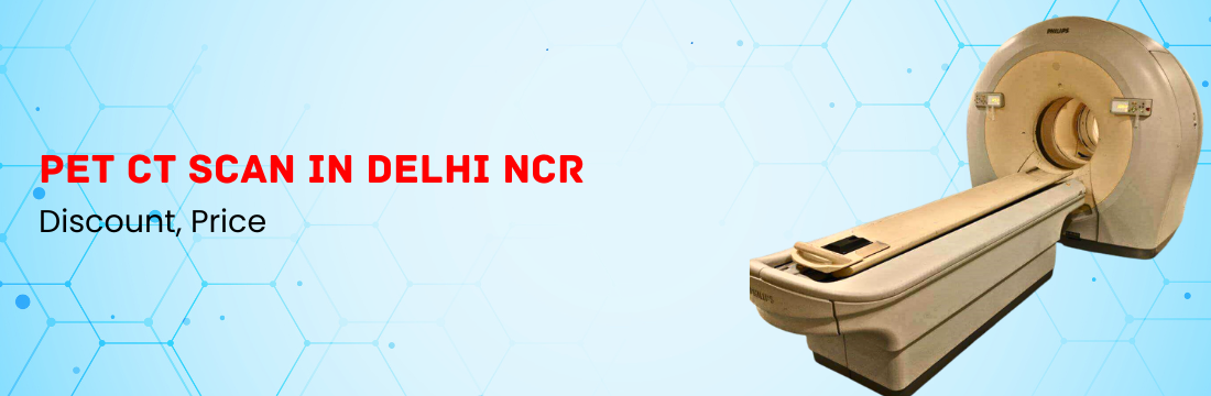 PET CT Scan in Delhi NCR